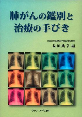 肺がんの鑑別と治療の手びき