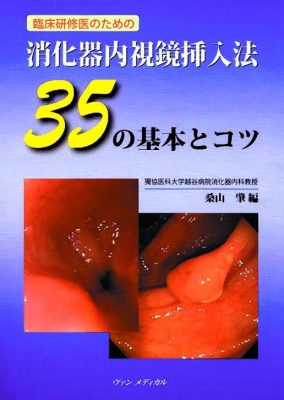 消化器内視鏡挿入法 35の基本とコツ