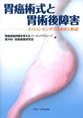 胃癌術式と胃術後障害－そのコンセンサスの現状と解説