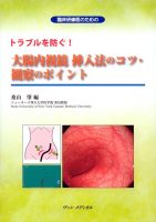 トラブルを防ぐ！　大腸内視鏡挿入法のコツ・観察のポイント